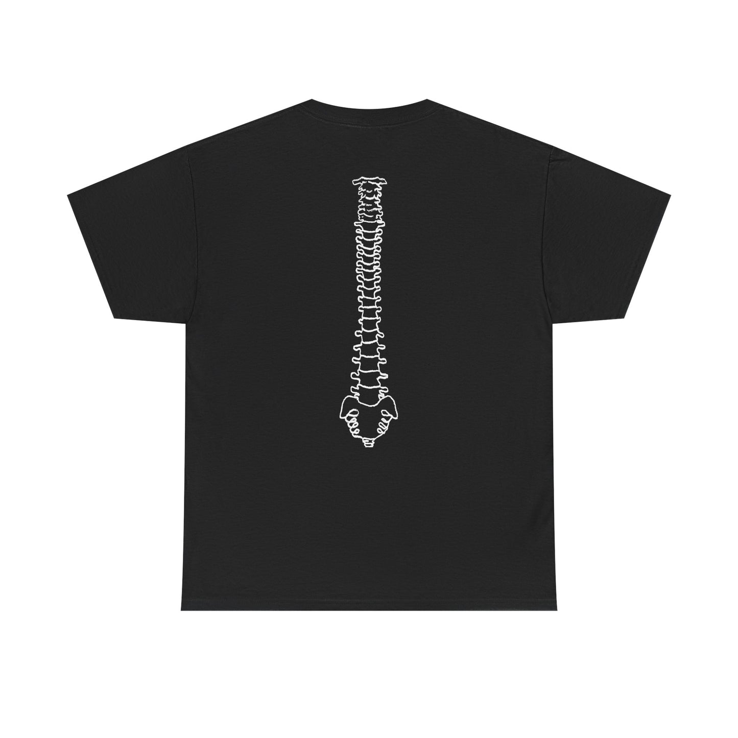 Tethered Cord + Spina Bifida Awareness